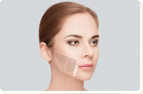 Área de atuação do procedimento Ultra Cheeks com Ultraformer III