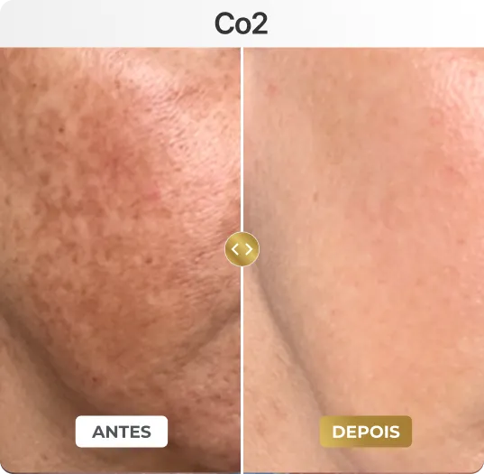 co1