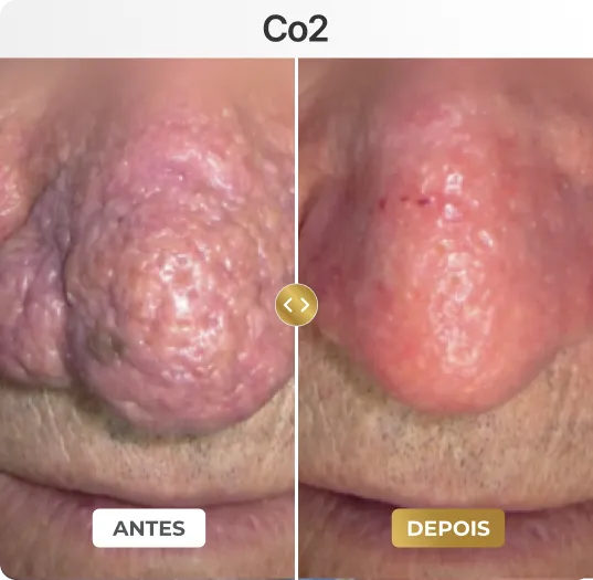 co2