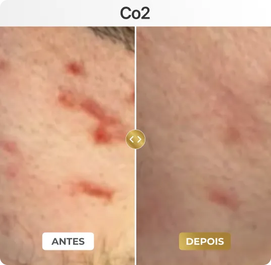 co4